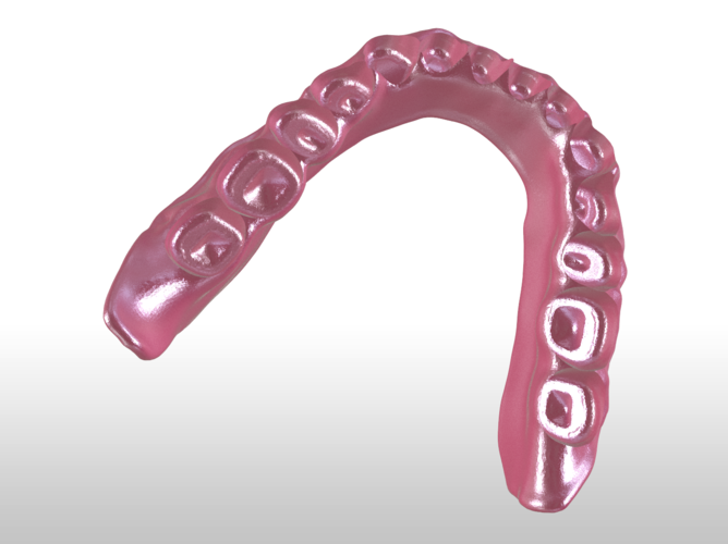 Digital Single Jaw Full Denture 3D Print 228765 Digital Single Jaw Full Denture 3D Print 228765