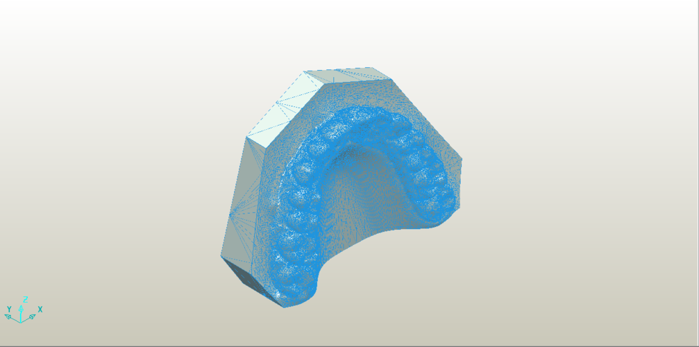 Mini Deprogrammer Splint 3D Print 260799 Mini Deprogrammer Splint 3D Print 260799