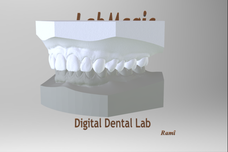Digital Orthodontic Study Models with Virtual Bases 3D Print 287989 Digital Orthodontic Study Models with Virtual Bases 3D Print 287989