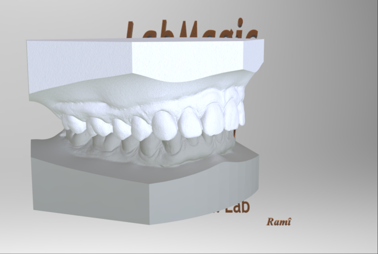 Digital Orthodontic Study Models with Virtual Bases 3D Print 287990 Digital Orthodontic Study Models with Virtual Bases 3D Print 287990