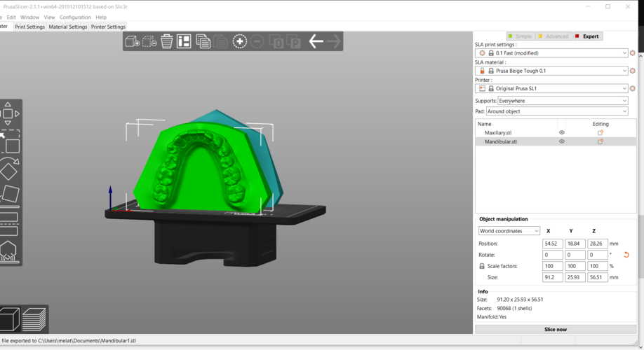 Digital Orthodontic Study Models with Virtual Bases 3D Print 287991 Digital Orthodontic Study Models with Virtual Bases 3D Print 287991