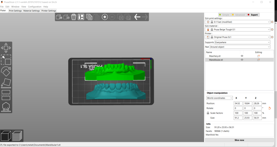 Digital Orthodontic Study Models with Virtual Bases 3D Print 287992 Digital Orthodontic Study Models with Virtual Bases 3D Print 287992