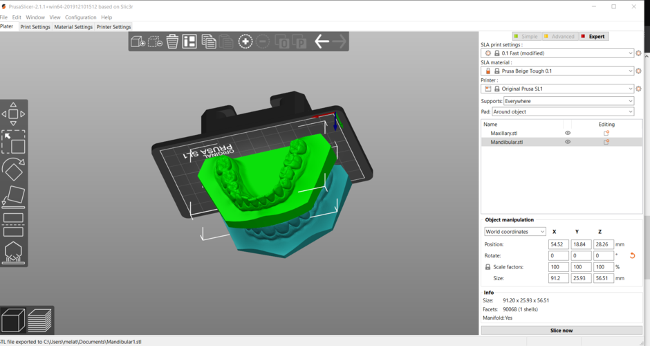 Digital Orthodontic Study Models with Virtual Bases 3D Print 287993 Digital Orthodontic Study Models with Virtual Bases 3D Print 287993