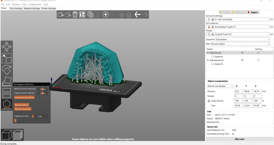 Digital Orthodontic Study Models with Virtual Bases 3D Print 287994 Digital Orthodontic Study Models with Virtual Bases 3D Print 287994