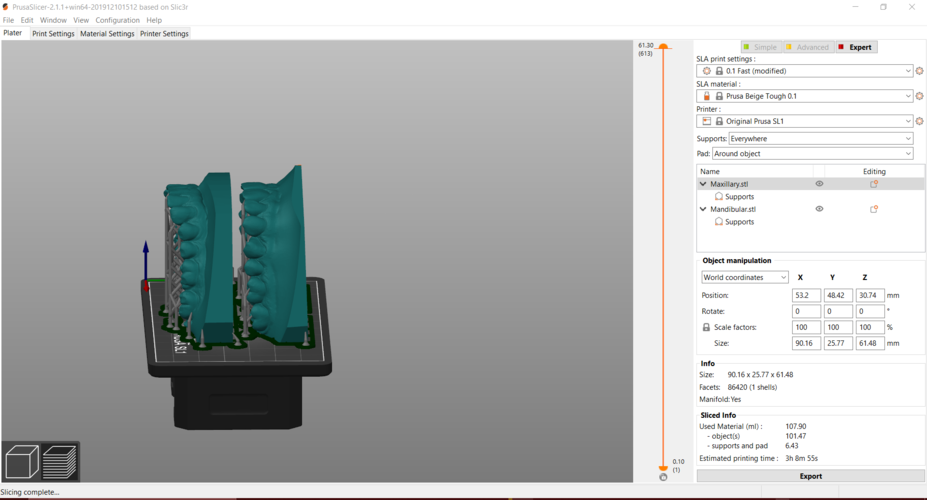 Digital Orthodontic Study Models with Virtual Bases 3D Print 287995 Digital Orthodontic Study Models with Virtual Bases 3D Print 287995