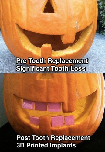 Pumpkin Tooth Replacement Project 3D Print 56217