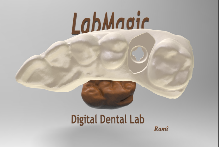 Digital Dental Implant Model with Soft Tissue 3D Print 64859 Digital Dental Implant Model with Soft Tissue 3D Print 64859