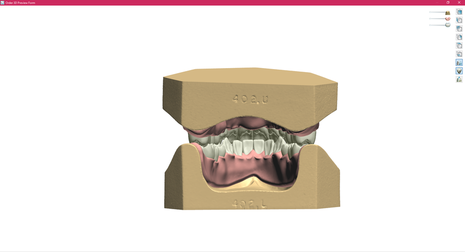 Digital Full Dentures 3D Print 83343 Digital Full Dentures 3D Print 83343