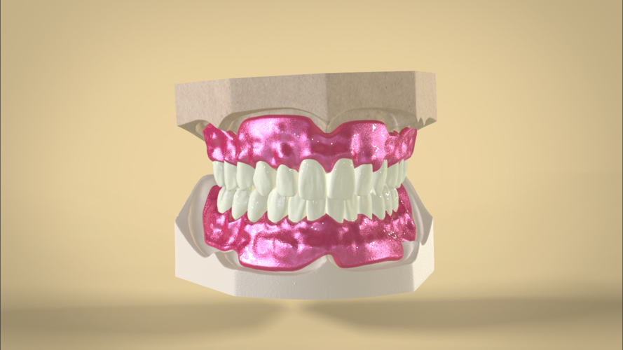 Digital Full Dentures 3D Print 83344 Digital Full Dentures 3D Print 83344