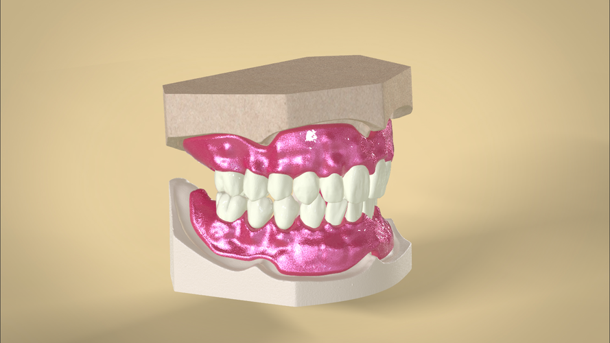 Digital Full Dentures 3D Print 83345 Digital Full Dentures 3D Print 83345