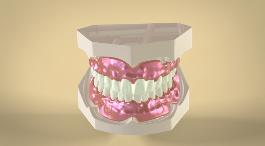 Digital Full Dentures 3D Print 83346 Digital Full Dentures 3D Print 83346