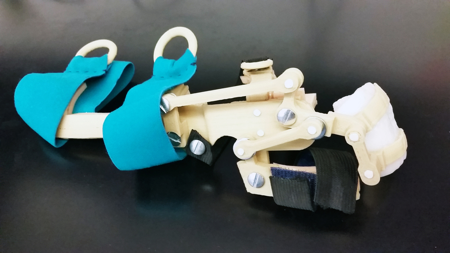 3D-Printed Wrist-Driven Orthosis (WDO) 3D Print 97991
