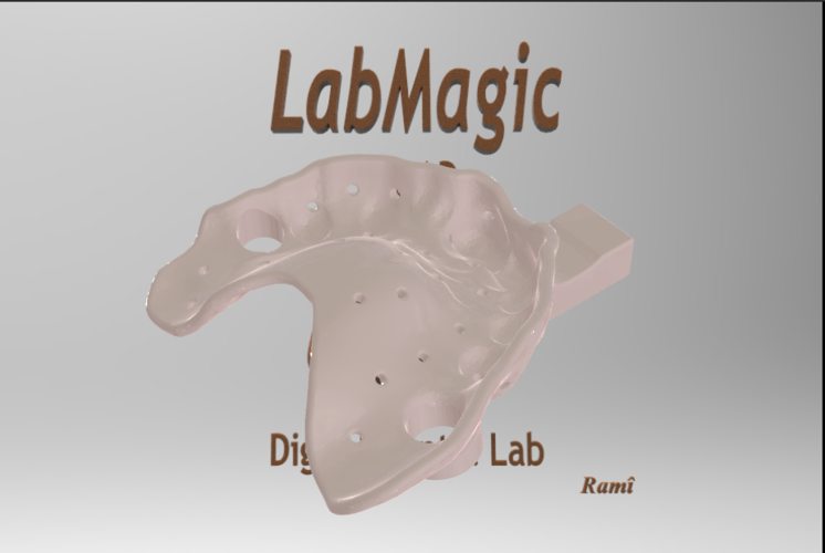 3D Printed Digital Dental Custom Impression Tray by LabMagic 3D CAD