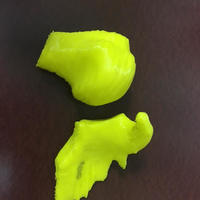 MOI 3D Medical Printing Program - Thumbnail 3