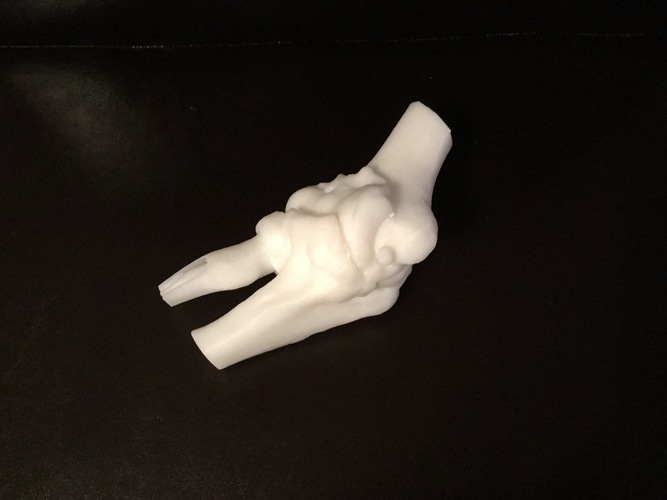 MOI 3D Medical Printing Program 3D Print 110171
