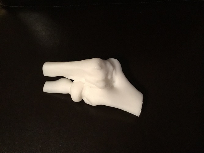 MOI 3D Medical Printing Program 3D Print 110172