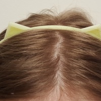Cat Ears Hair Band - Thumbnail 4