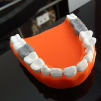 Small Teeth with a silver teeth prothesis 3D Printing 120142