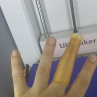 Finger Mold and Finger Cast - Thumbnail 3
