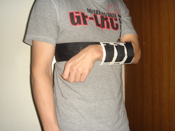 Modular bracer for astronauts (MoBr v1.0) 3D Print 123629