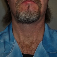 CONSCIENCE  (Angel on my shoulder) - Thumbnail 2