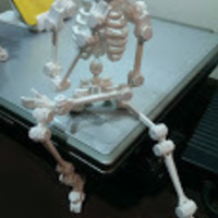 robot about the bone collector - Thumbnail 3