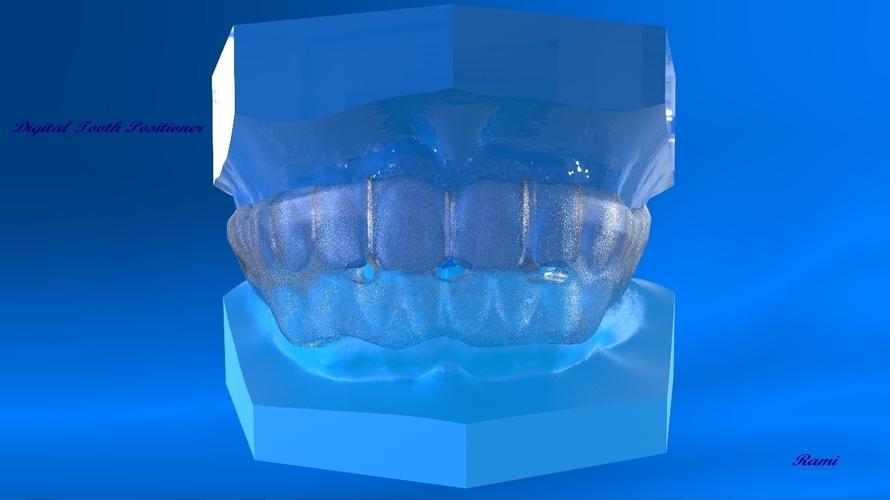 Digital Tooth Positioner