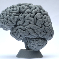 Human Brain - Thumbnail 3