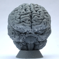 Human Brain - Thumbnail 4
