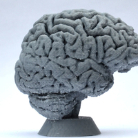Human Brain - Thumbnail 5