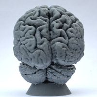 Human Brain - Thumbnail 6