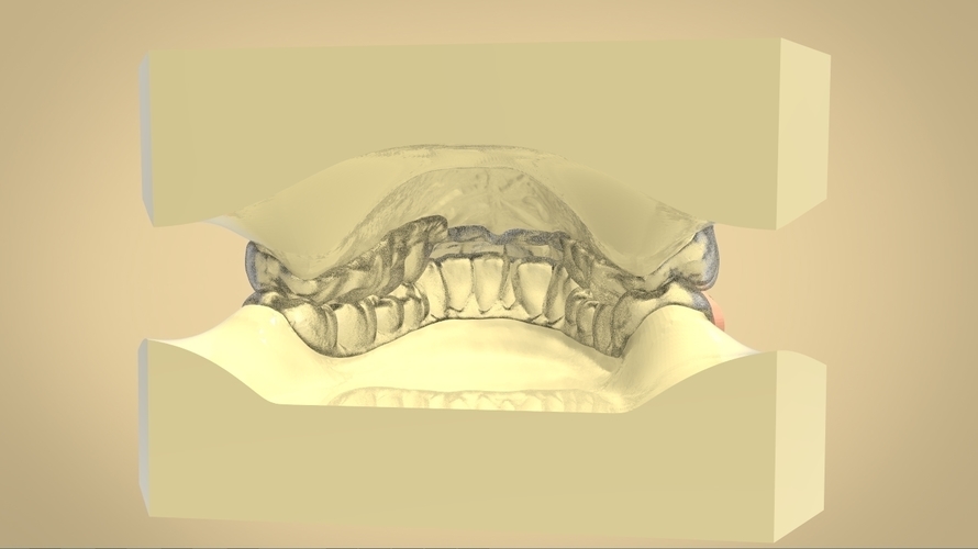 elastic mandibular advancement device