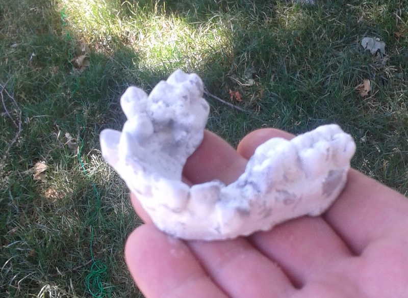 Malocclusion, Misalignment of Teeth, Dental Autopsy Scan