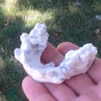 Malocclusion, Misalignment of Teeth, Dental Autopsy Scan - Thumbnail 2