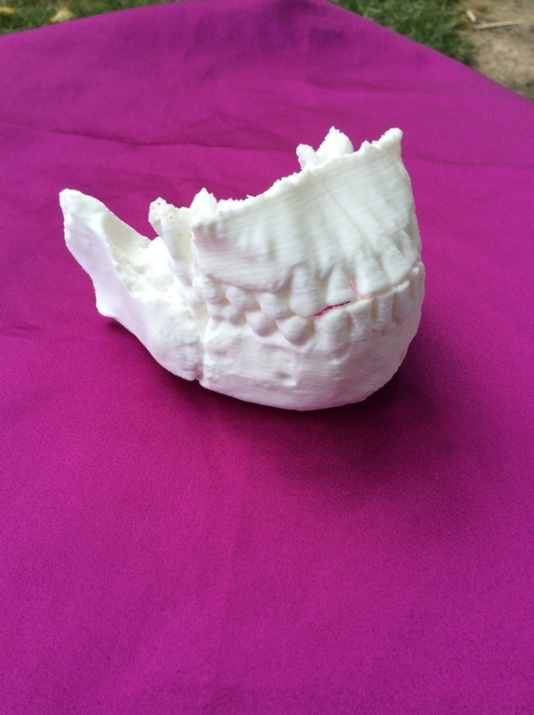 Medium Homo Naledi Skull Reconstruction - Lower Face 3D Printing 166786