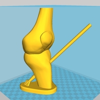 Arrow in the knee - Thumbnail 2