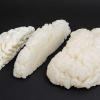 mri brain  - Thumbnail 1