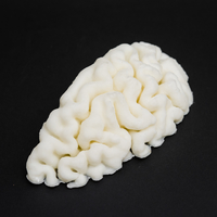 mri brain  - Thumbnail 3