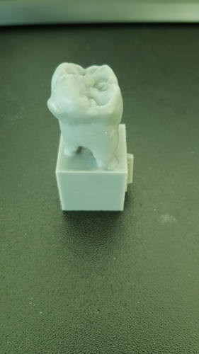 Wisdom tooth 3D Print 179016