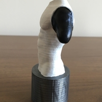 Transhumeral (above-elbow) limb loss/difference model for prosth - Thumbnail 3