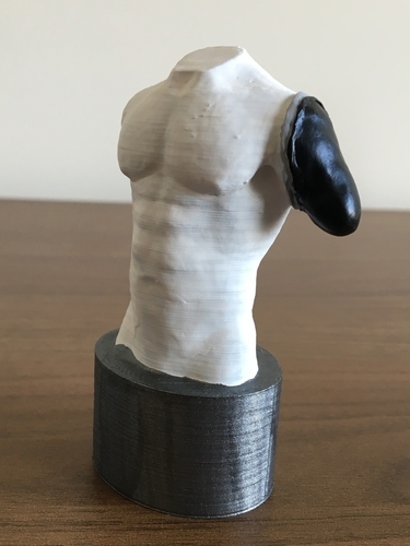 Transhumeral (above-elbow) limb loss/difference model for prosth 3D Print 184379