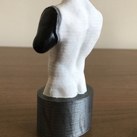 Transhumeral (above-elbow) limb loss/difference model for prosth - Thumbnail 5
