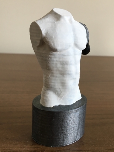 Transhumeral (above-elbow) limb loss/difference model for prosth 3D Print 184381