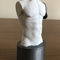 Transhumeral (above-elbow) limb loss/difference model for prosth - Thumbnail 6