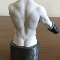 Transradial (below-elbow) limb loss/difference model for prosthe - Thumbnail 4