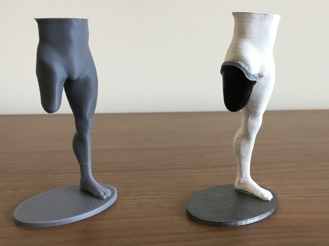 Transfemoral (above-knee) limb loss/difference model for prosthe 3D Print 184400