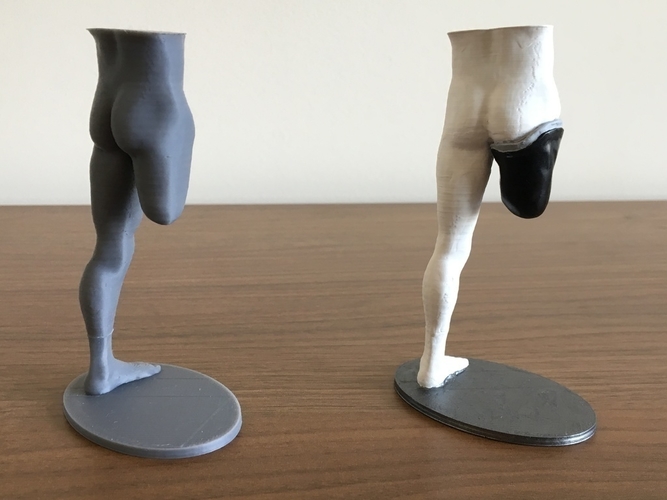 Transfemoral (above-knee) limb loss/difference model for prosthe 3D Print 184402