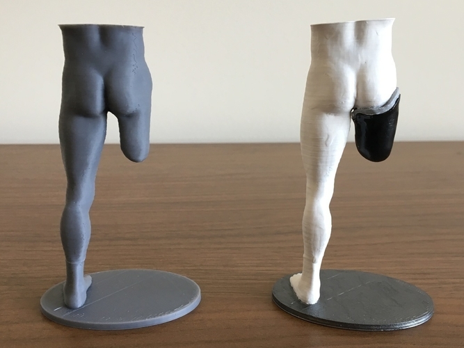 Transfemoral (above-knee) limb loss/difference model for prosthe 3D Print 184403