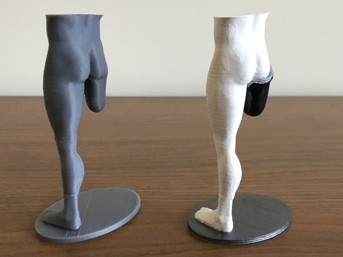 Transfemoral (above-knee) limb loss/difference model for prosthe 3D Print 184404