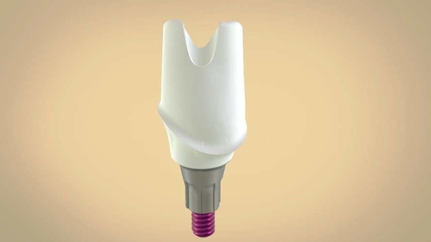 Digital Custom TiBase Abutment